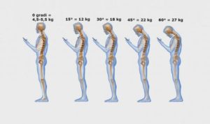 inclinazione del collo e peso percepito quando si osserva lo smartphone: 0°=4,5-5 kg; 15°=12kg; 30°=18Kg; 45°=22kg; 60°=27kg 