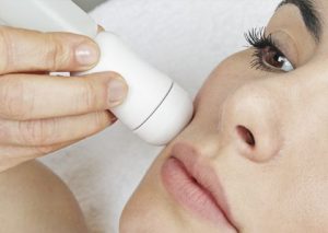 elettroporazione viso estate