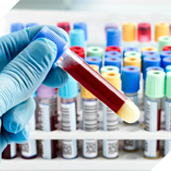 Laboratorio Analisi