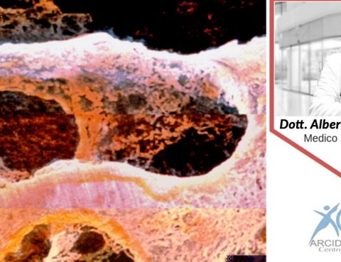 Osteoporosi e morfometria vertebrale