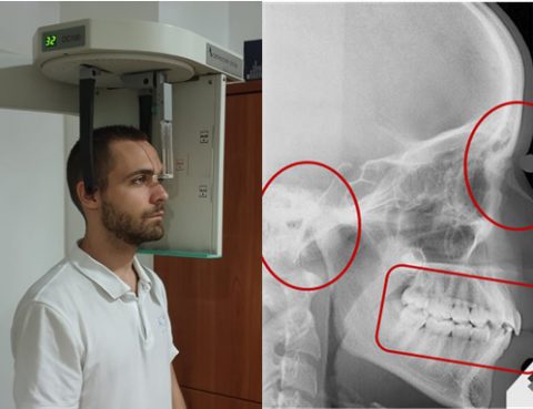 ORTOPANTOMOGRAFO e APPARECCHI DENTALI