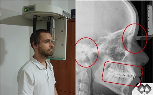 ORTOPANTOMOGRAFO e APPARECCHI DENTALI