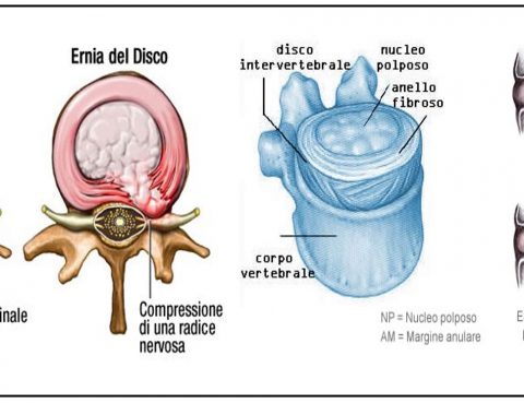 dolore alla cervicale