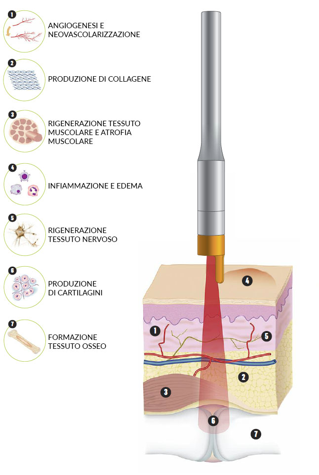 Podia Laser Bio - laser a diodo - Centro Medico Arcidiacono