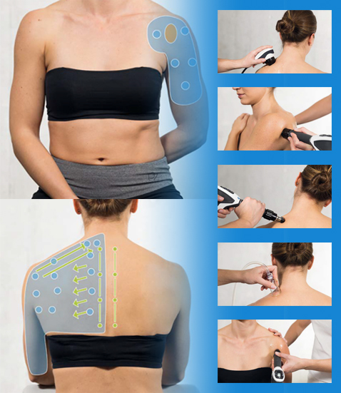 Physical Tissue Stimulation - combinare diverse terapie fisiche